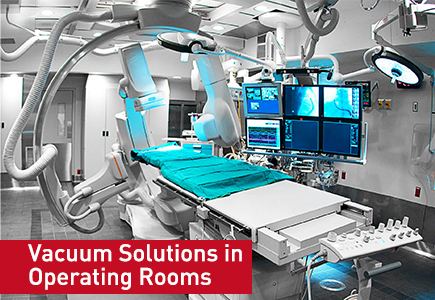 Vacuum Solutions in Operating Rooms: Enhancing Surgical Efficiency